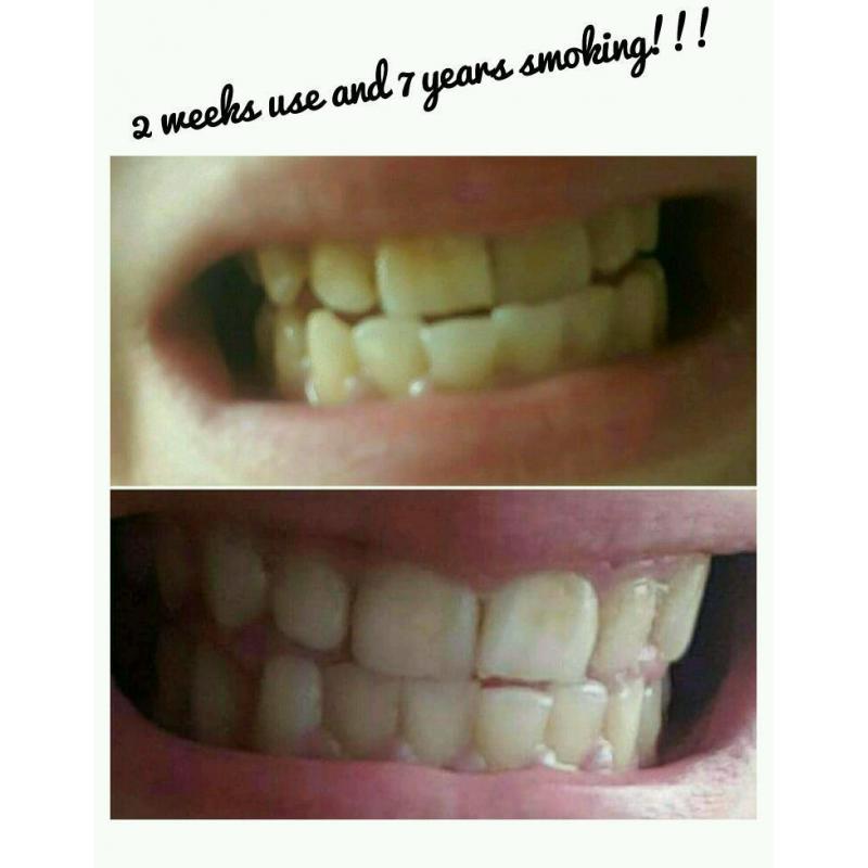 Whitening toothpaste & opportunity to sell